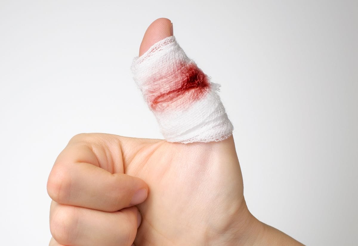 A close-up of a bandaged thumb with visible blood on the gauze, illustrating the importance of having proper first aid supplies.