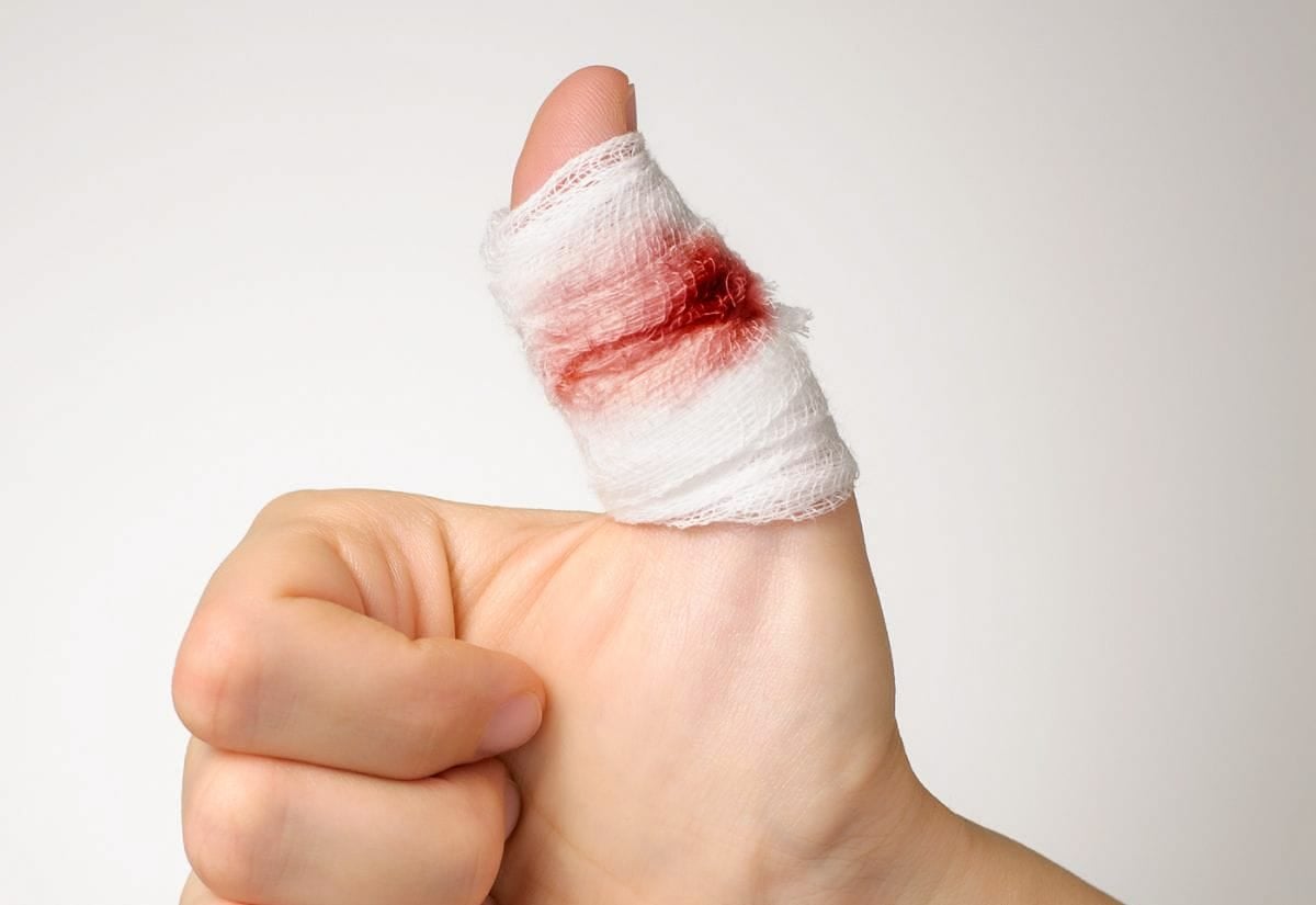 Close-up of a thumb wrapped in gauze with visible blood showing through, symbolizing a minor injury managed with home first aid.